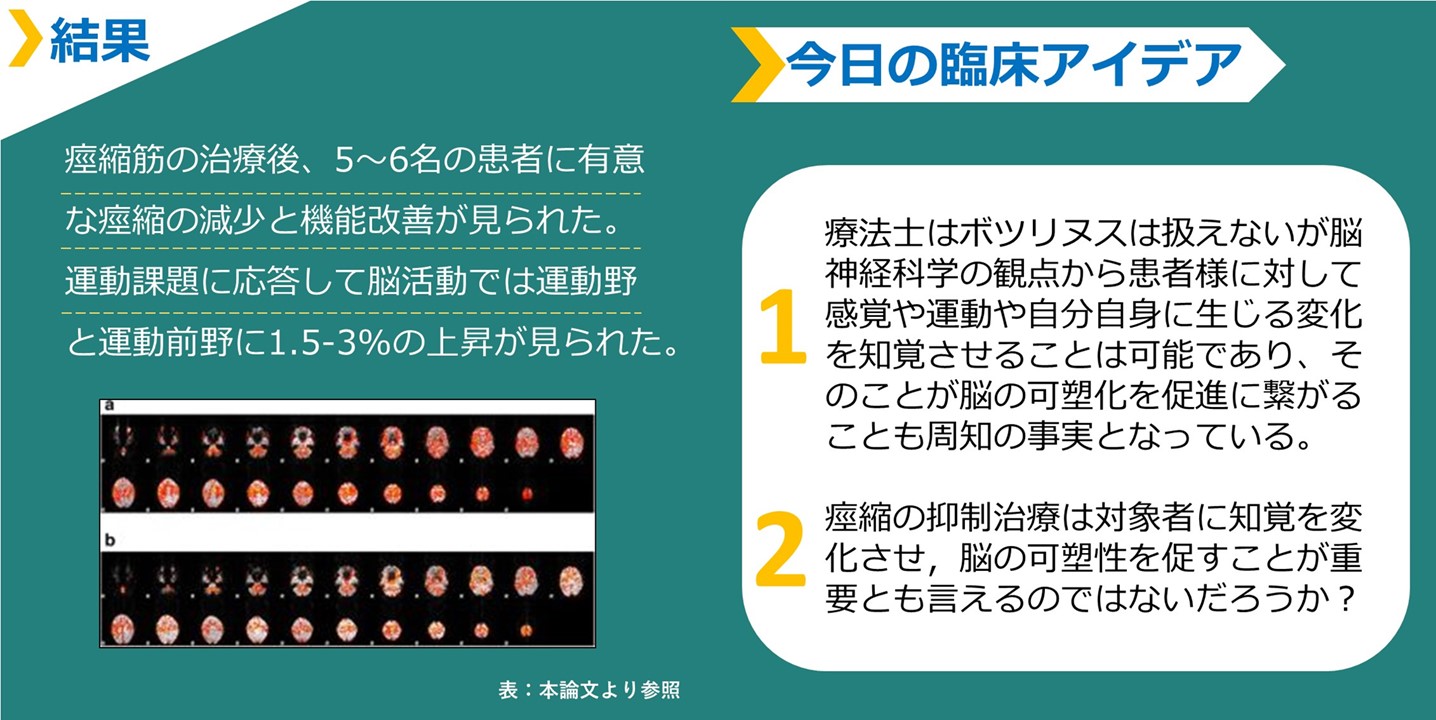 痙縮筋に対するボトックス治療が脳活動と運動機能に与える影響とは？見出し２