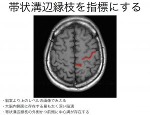 キャプチャ3