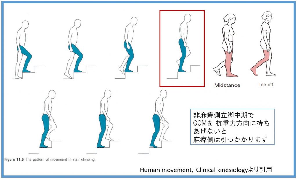 片麻痺の階段昇降時における足尖のひっかかり 脳卒中 脳梗塞のリハビリ論文サマリー 脳卒中 神経系 自費リハビリ施設 Stroke Lab 東京