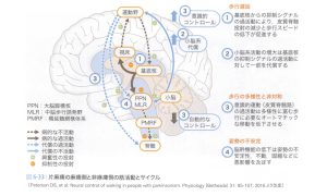 脳卒中患者のパーキンソン病様歩行