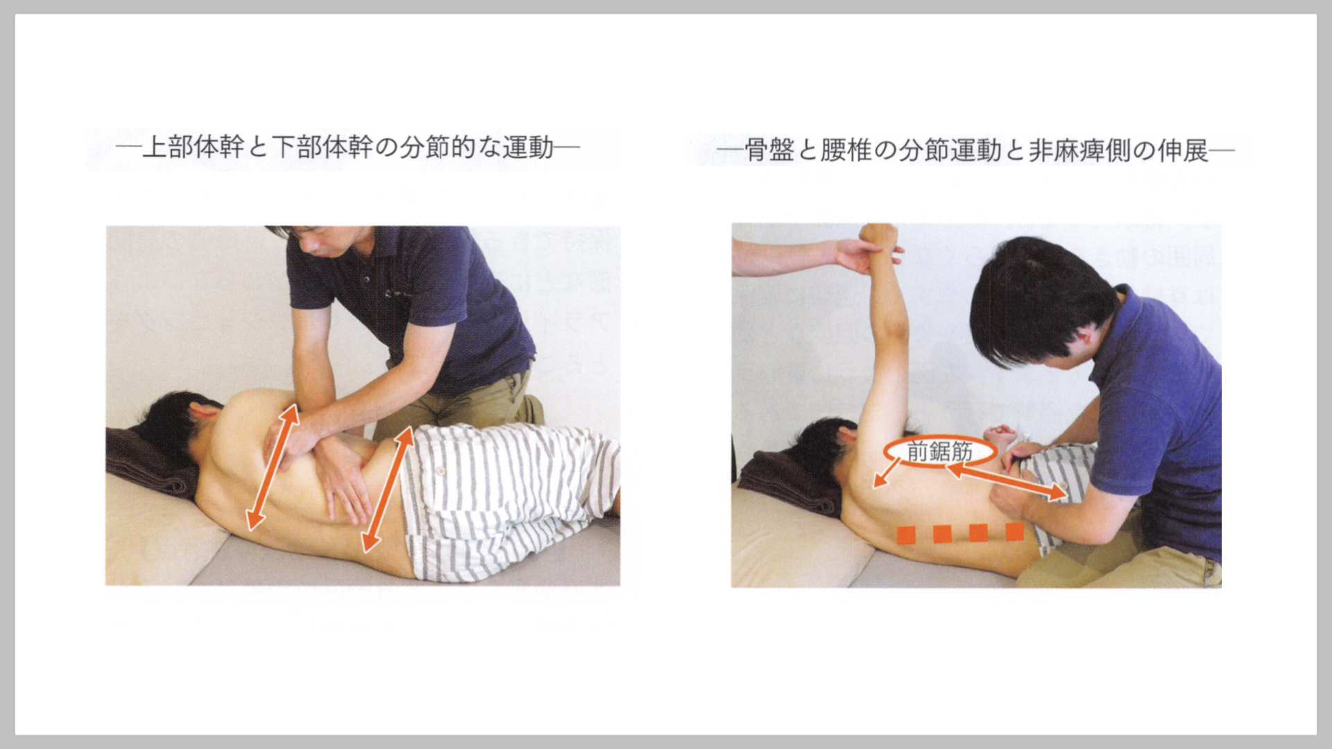 片麻痺患者の寝返り治療例（2）