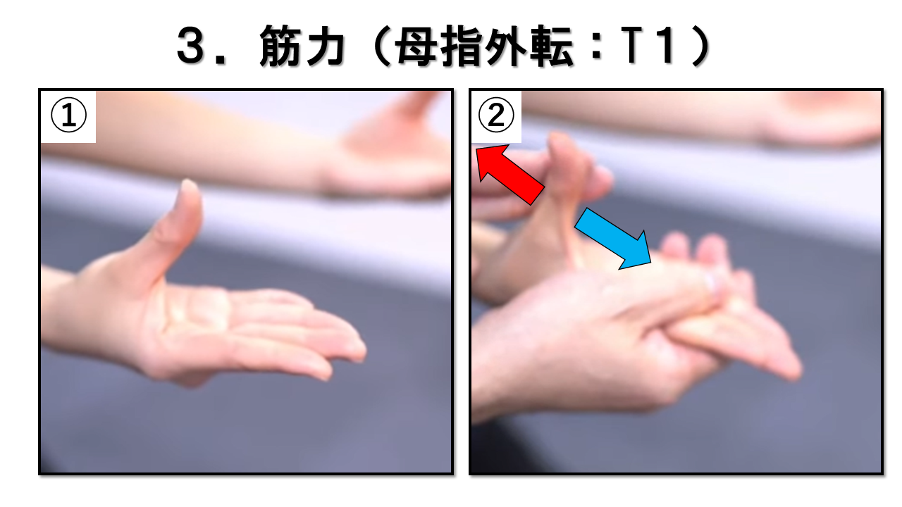 上肢の神経学的検査：筋力　母指外転