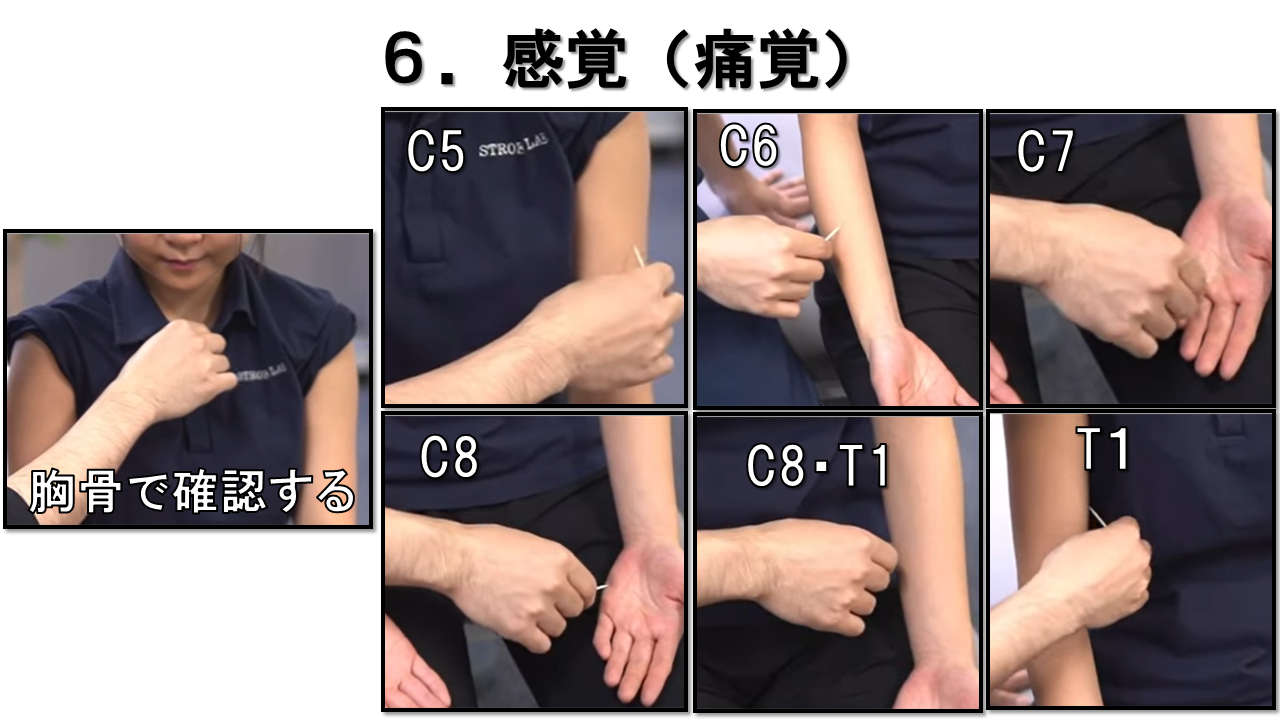 上肢の神経学的検査：痛覚