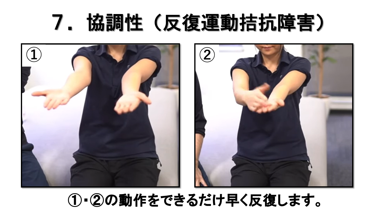 上肢の神経学的検査：協調性　反復運動拮抗障害