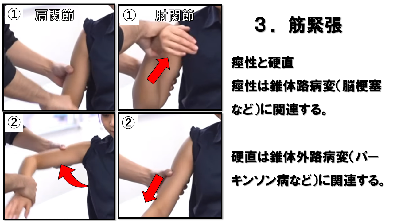 上肢の神経学的検査：筋緊張