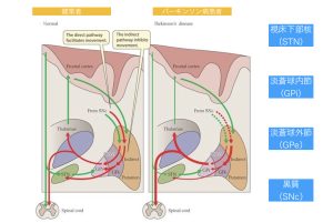 パーキンソン病　投射経路