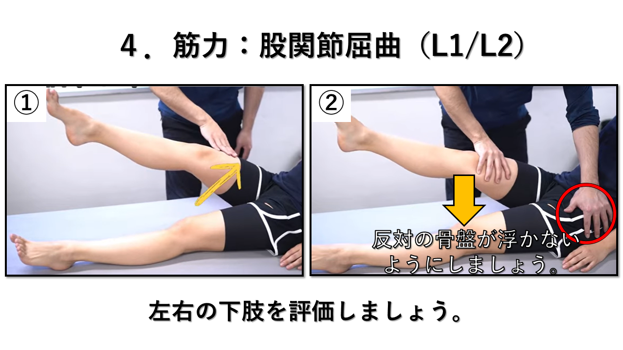 股関節の屈曲： L1/2（腸腰筋神経）の説明画像