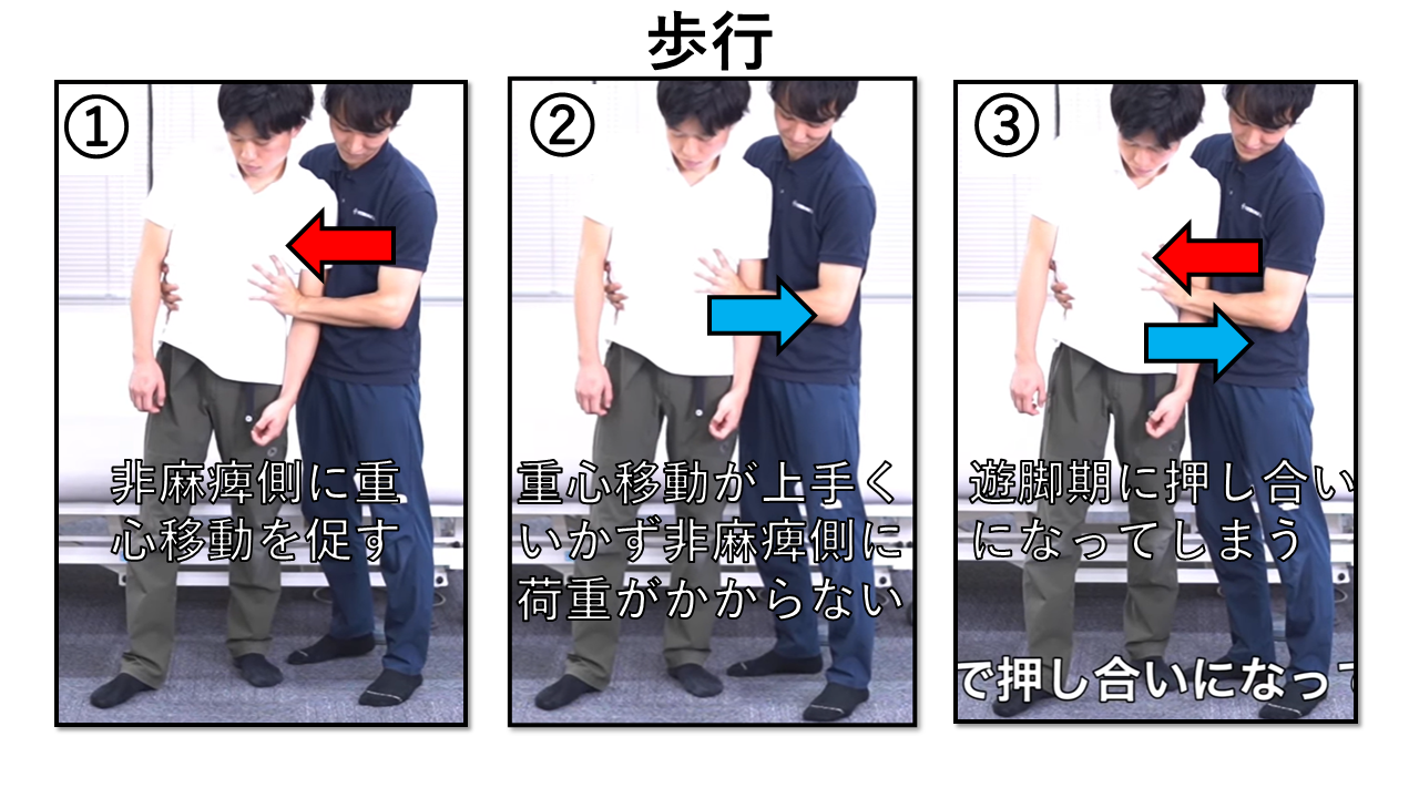 BLSの歩行の評価を画像で示します