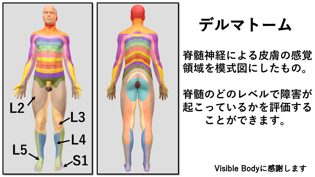 デルマトームは脊髄神経による皮膚の感覚領域を模式図にしたもの