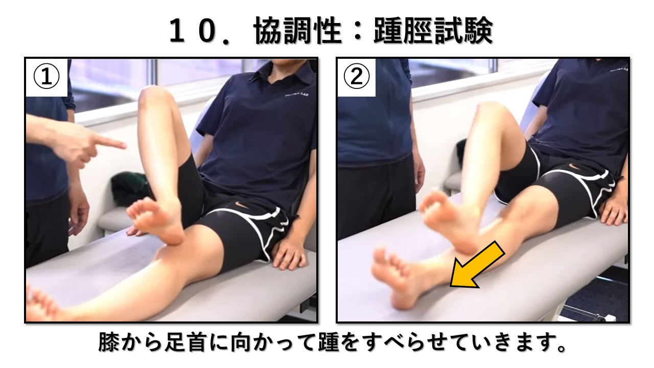協調性検査（踵脛試験）の説明画像