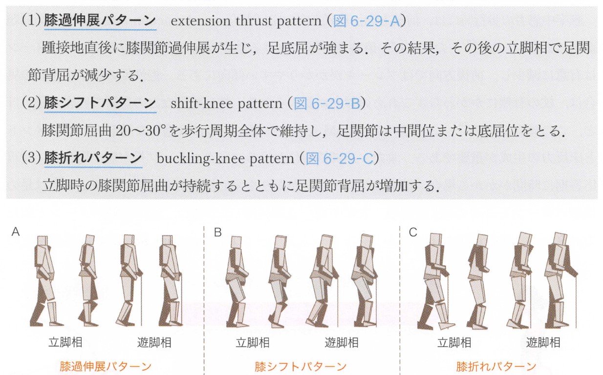 脳卒中患者に対する課題指向型トレ－ニング