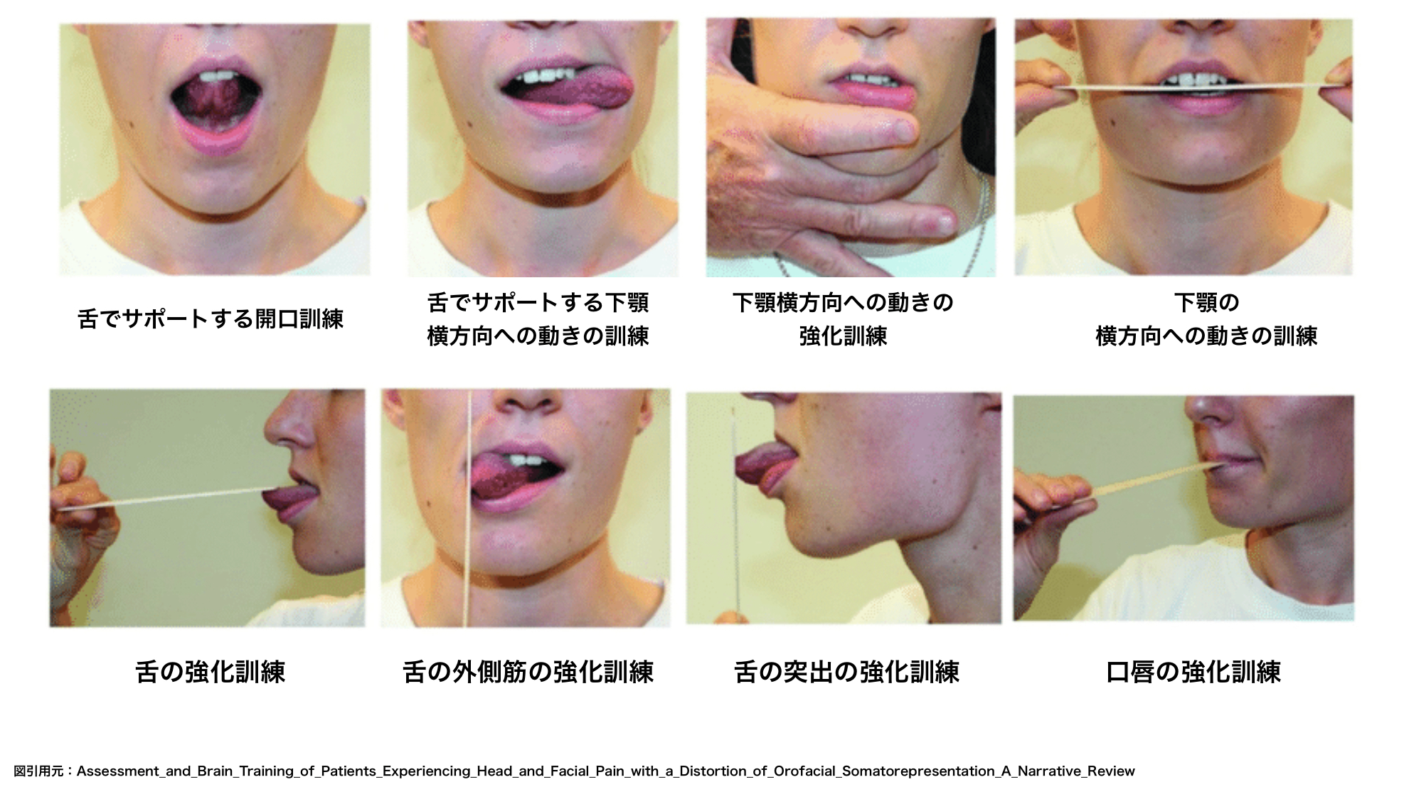 舌のリハビリテーション