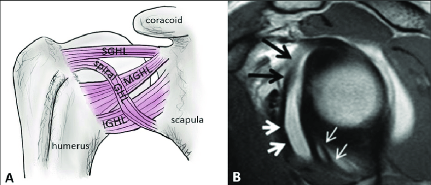 Superior glenohumeral ligament