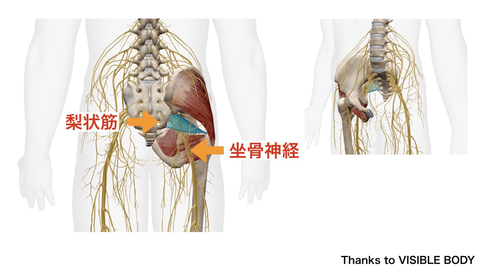 梨状筋症候群の治療
