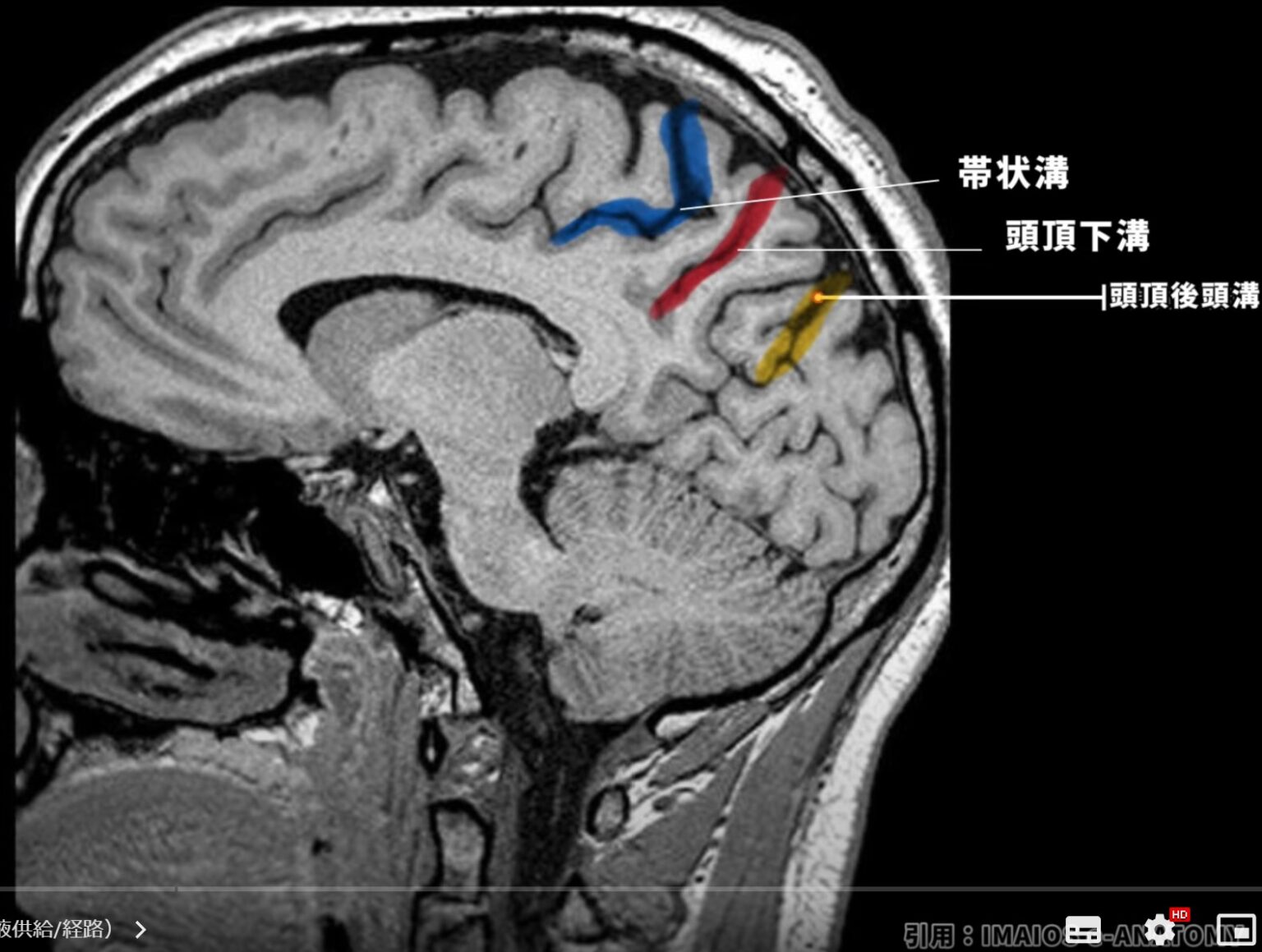 【2024年版】楔前部の機能とリハビリ実践:睡眠・記憶障害への効果的アプローチ! – STROKE LAB 東京/大阪 自費リハビリ | 脳 ...