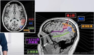 【2024年版】下頭頂小葉とゲルストマン症候群!リハビリによる日常生活への応用 – STROKE LAB 東京/大阪 自費リハビリ | 脳卒中/神経系