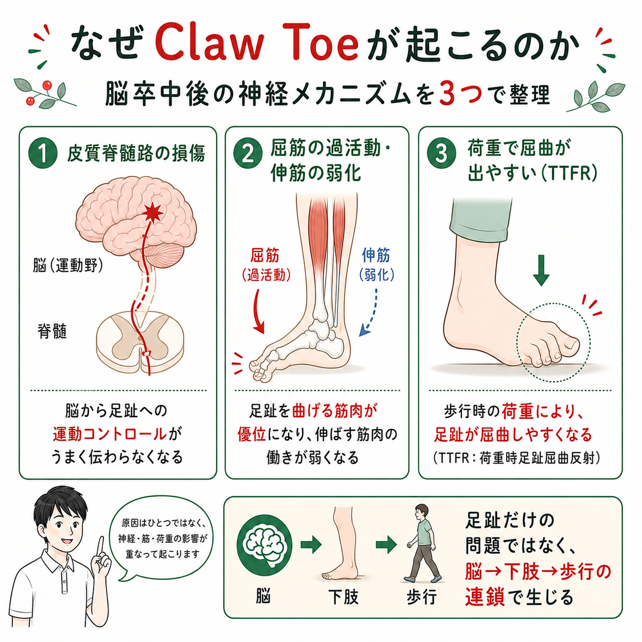 2026年版】脳卒中後のClaw Toe（足趾屈曲変形）対策｜Toe Spreader