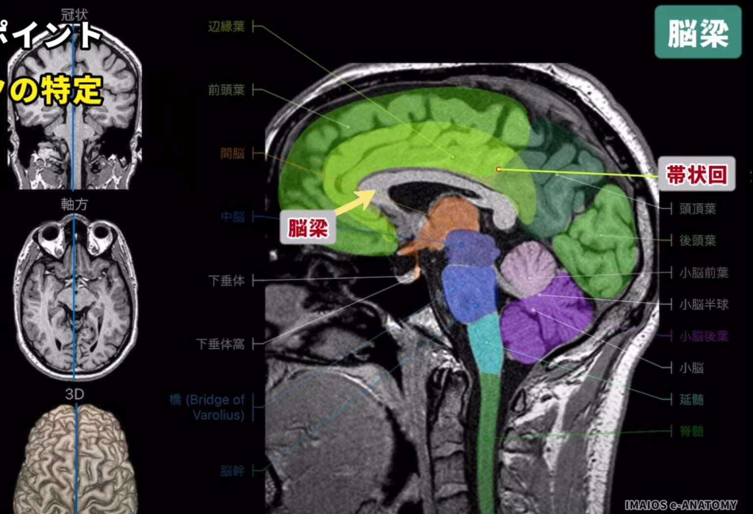 【2025年版】帯状回を徹底解説!役割〜痛みと認知的アプローチによるリハビリ成功のカギ – STROKE LAB 東京/大阪 自費リハビリ ...