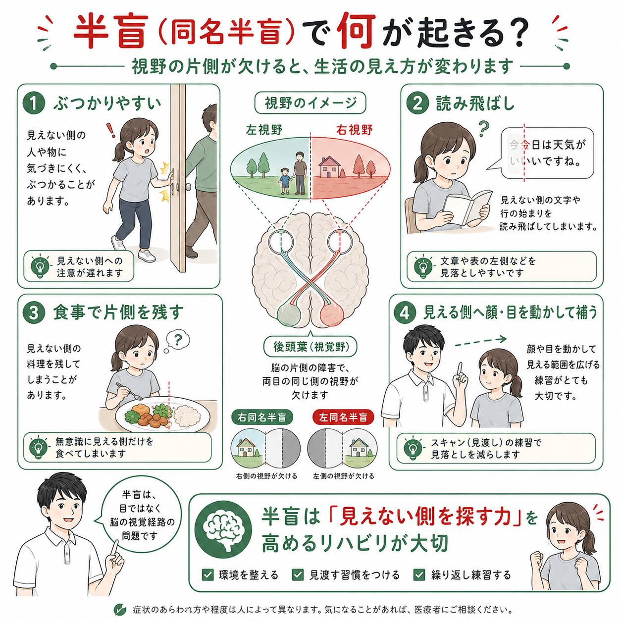脳卒中症候群　　裁断済み 2026年版】半盲の原因・機序・診断・予後・リハビリテーションまで解説