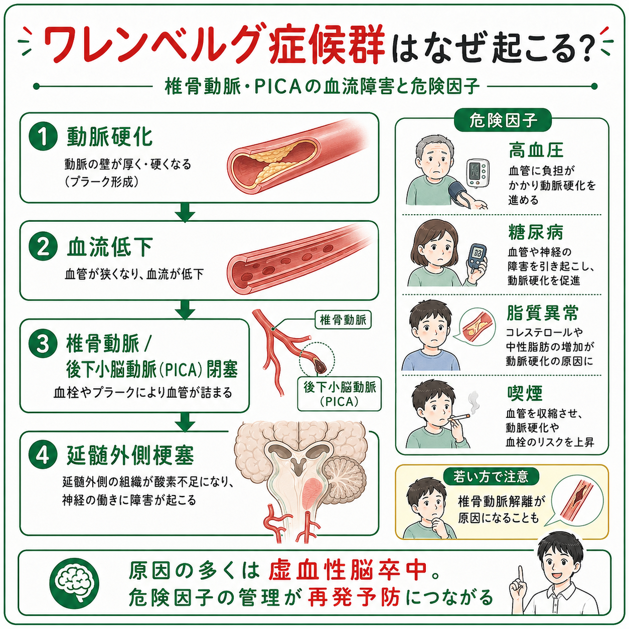 2026年版】ワレンベルグ症候群とは？リハビリテーションと予後予測