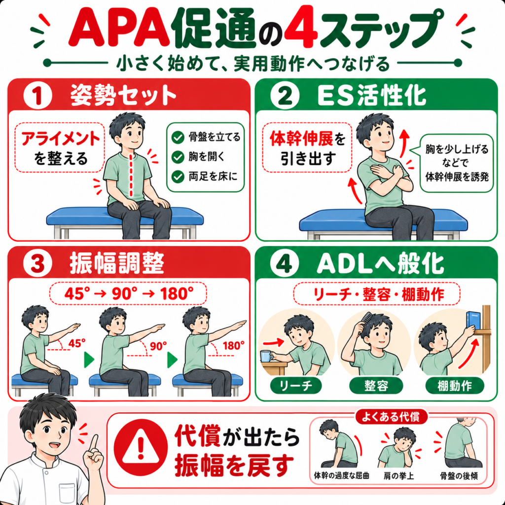 姿勢セット・脊柱起立筋活性化・振幅調整・ADL般化によるAPA促通の4ステップ