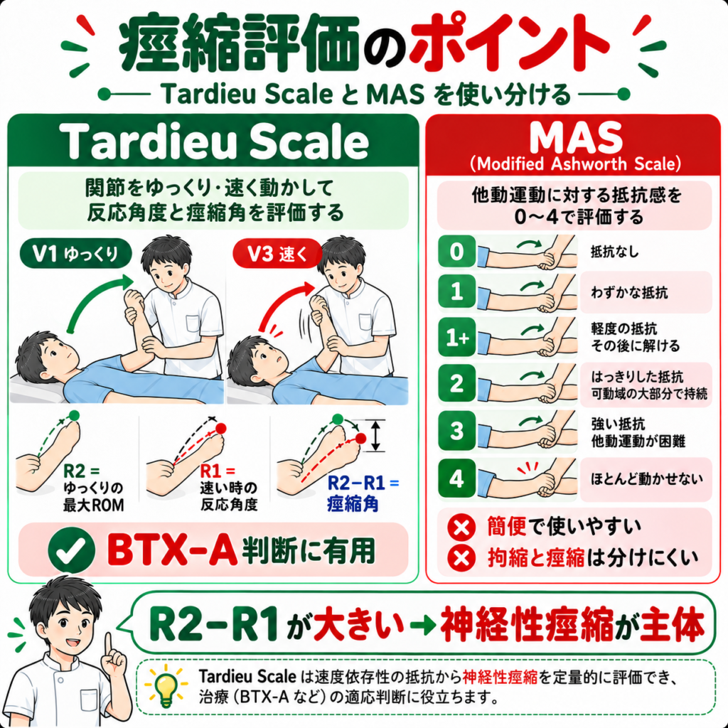 Tardieu ScaleとModified Ashworth Scaleによる脳卒中後痙縮評価の違いを示す図解