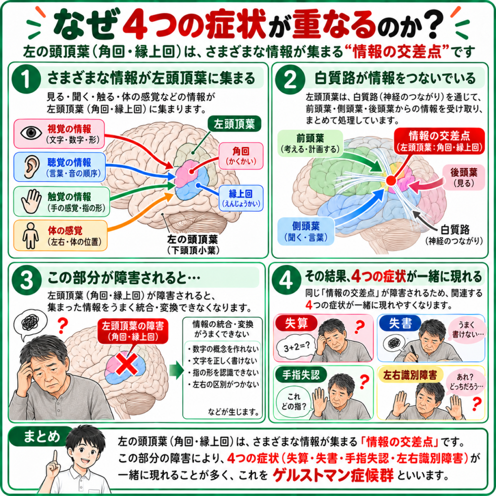 左頭頂葉の角回・縁上回に視覚・聴覚・触覚・身体感覚の情報が集まり、ゲルストマン症候群の4症状が生じる仕組みを示した図解