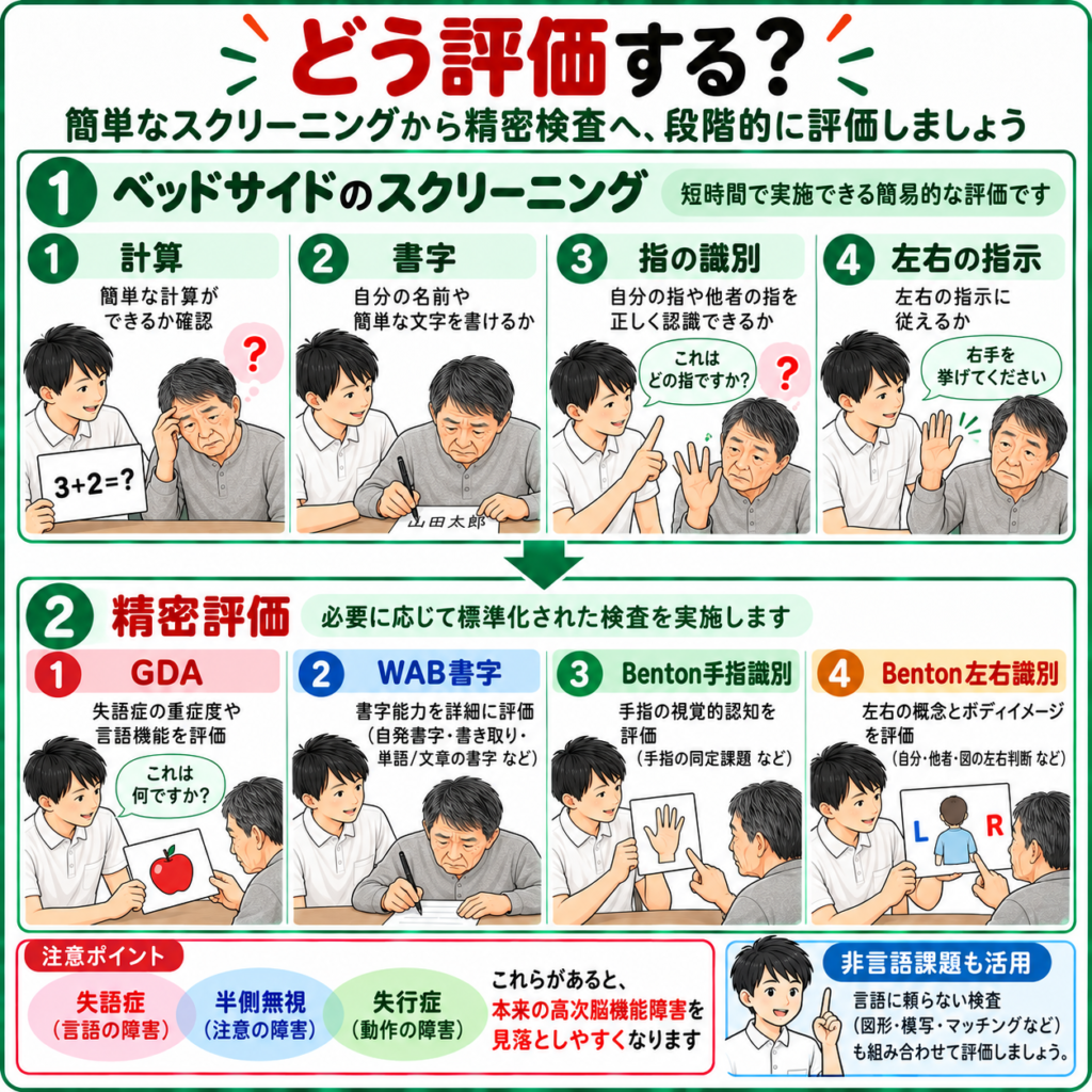 ゲルストマン症候群のベッドサイドスクリーニングと失算・失書・手指失認・左右識別障害の精密評価を示した図解