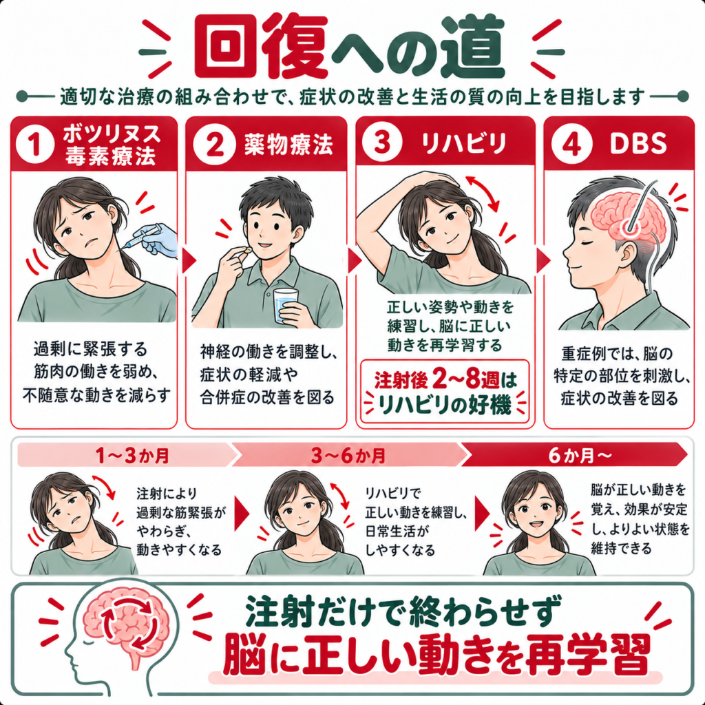 ジストニアに対するボツリヌス毒素療法・薬物療法・リハビリ・DBSの治療と回復過程の図解