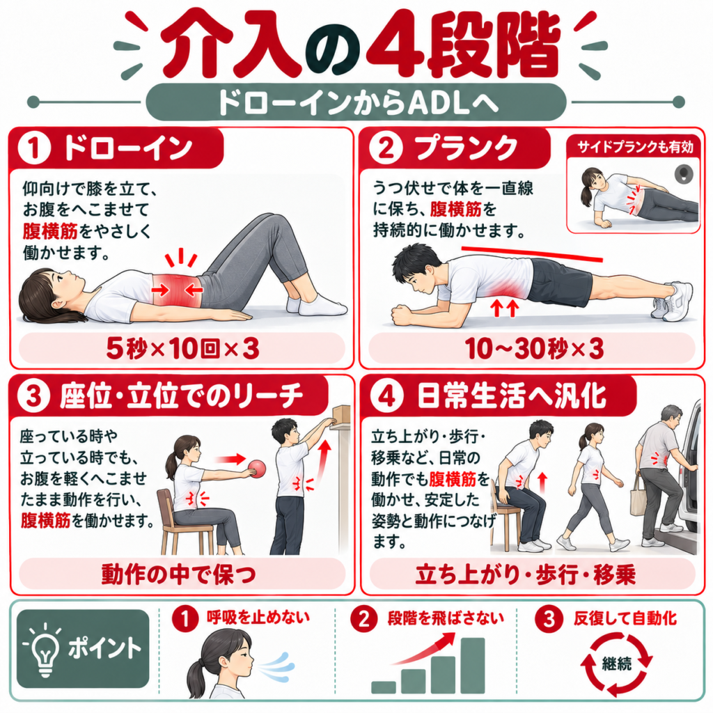 腹横筋トレーニングをドローインからプランク・リーチ・日常生活動作へ進める4段階の図解