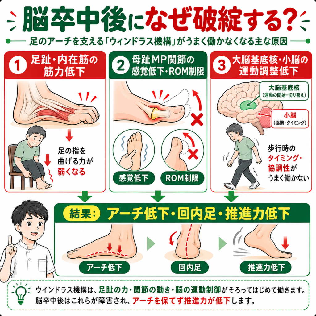 脳卒中後にウインドラス機構が破綻する原因を足趾筋力低下・母趾感覚障害・関節可動域制限・運動協調性低下から解説