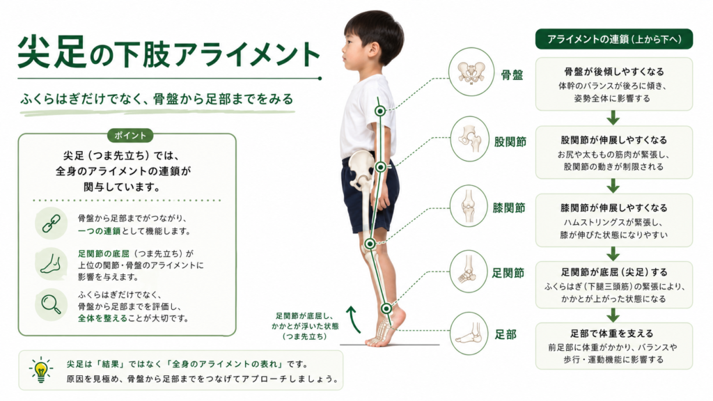 尖足のアライメント