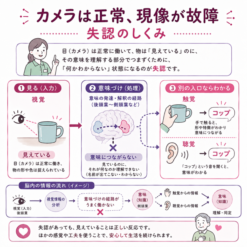 失認のしくみ