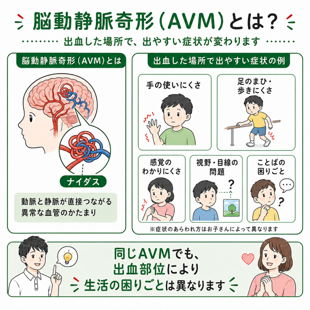 脳動静脈奇形とは
