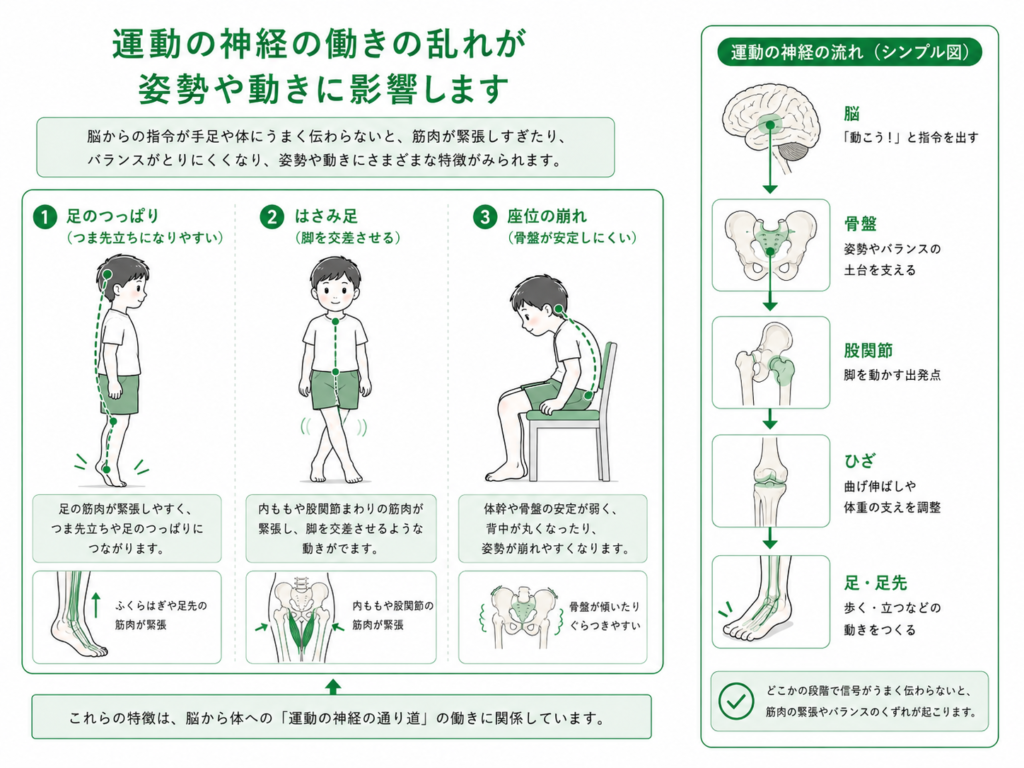 PVL(脳室周囲白質軟化症)の子のリハビリ｜発達の見通しと家庭での
