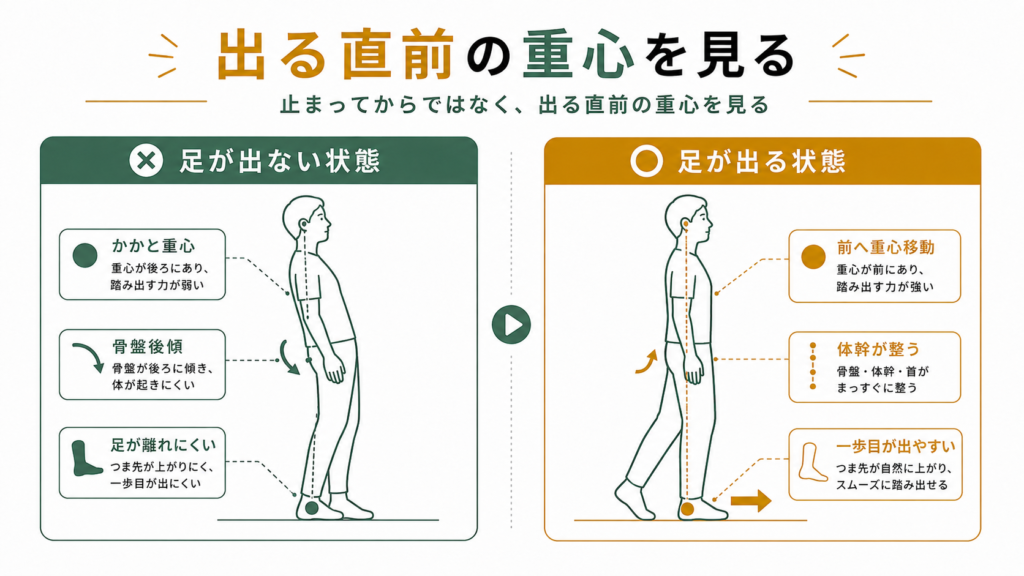 すくみ足が出やすい姿勢