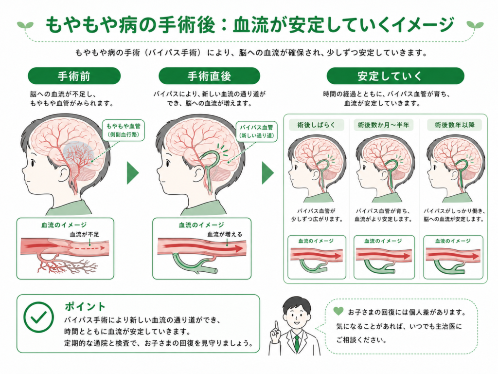 モヤモヤ病の術後