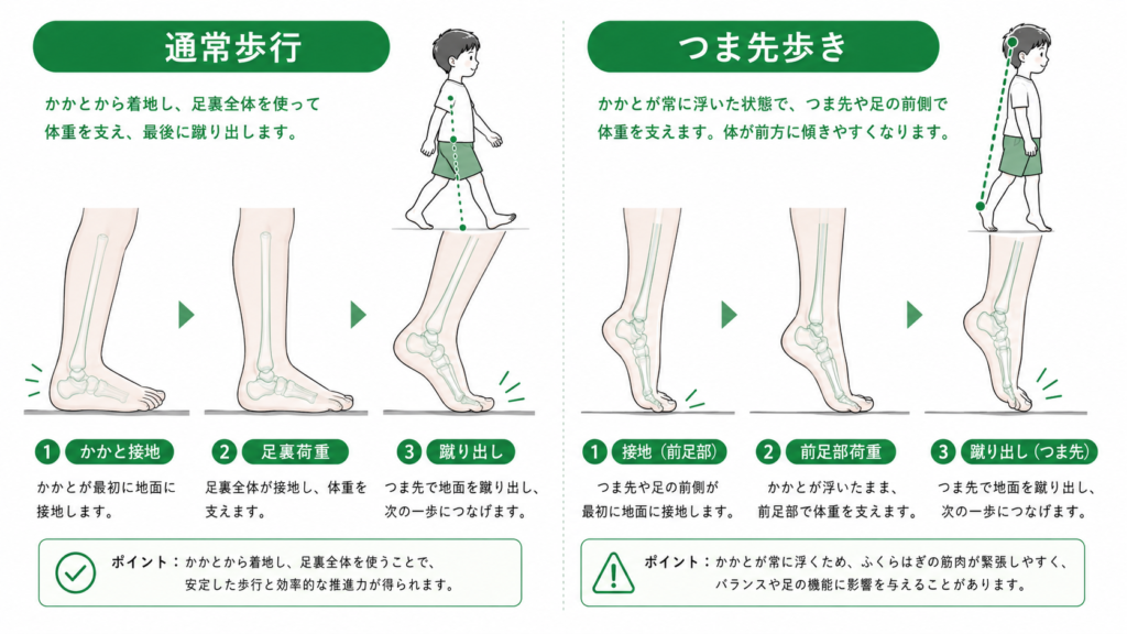 通常歩行とつま先歩行