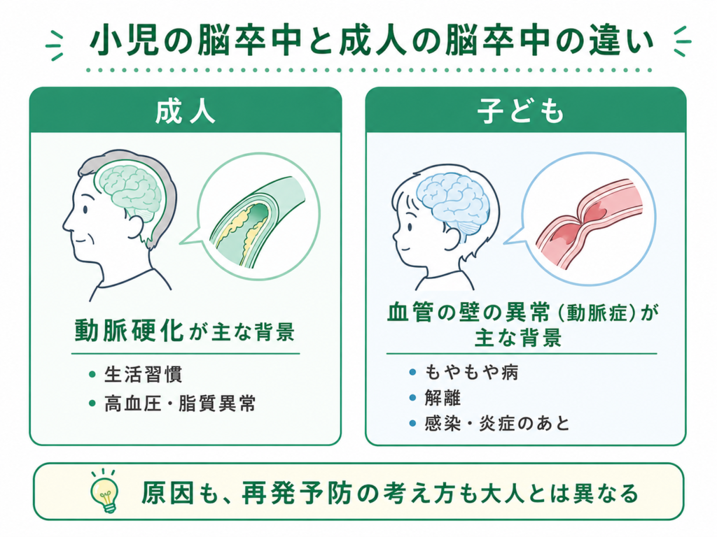 大人と子供の脳卒中の違い